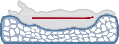 Trixie Vital Bendson Orthopedisch Hondenkussen