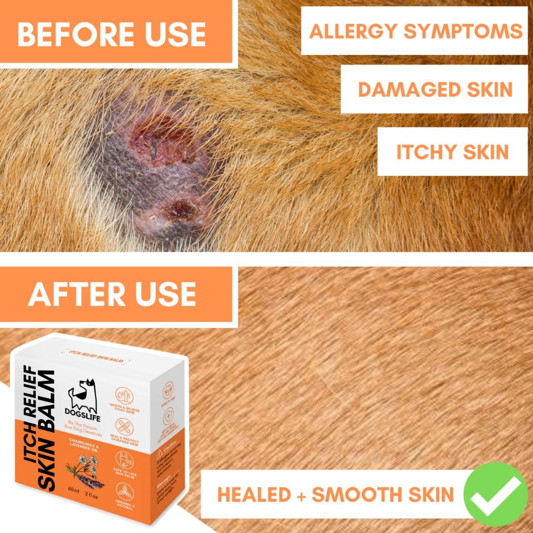 Itch Relief Skin Balm